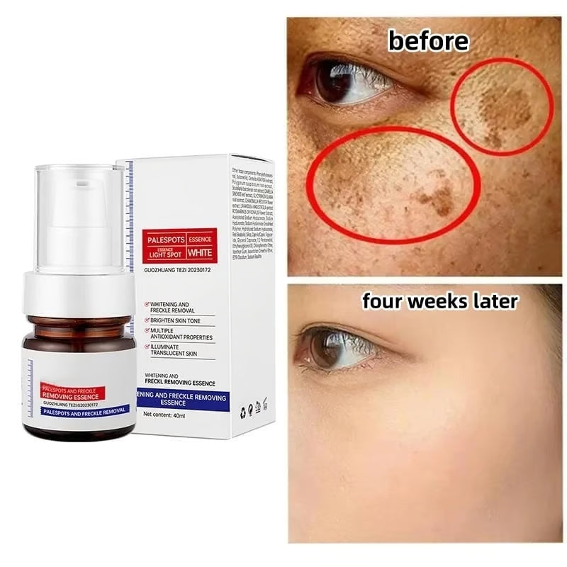 Whitening and Freckle Removing Essence