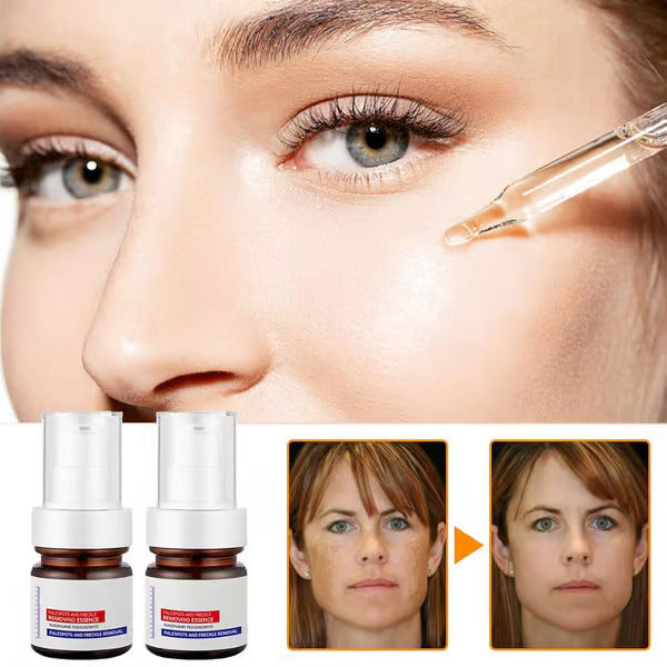 Whitening and Freckle Removing Essence