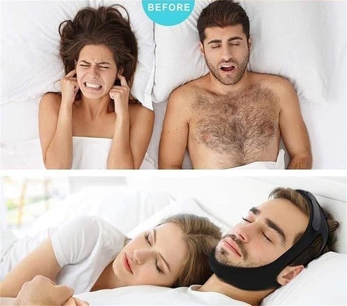 AirFlow Jaw Strap - (SET OF 2)