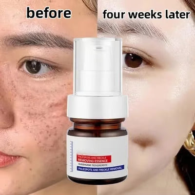 Whitening and Freckle Removing Essence