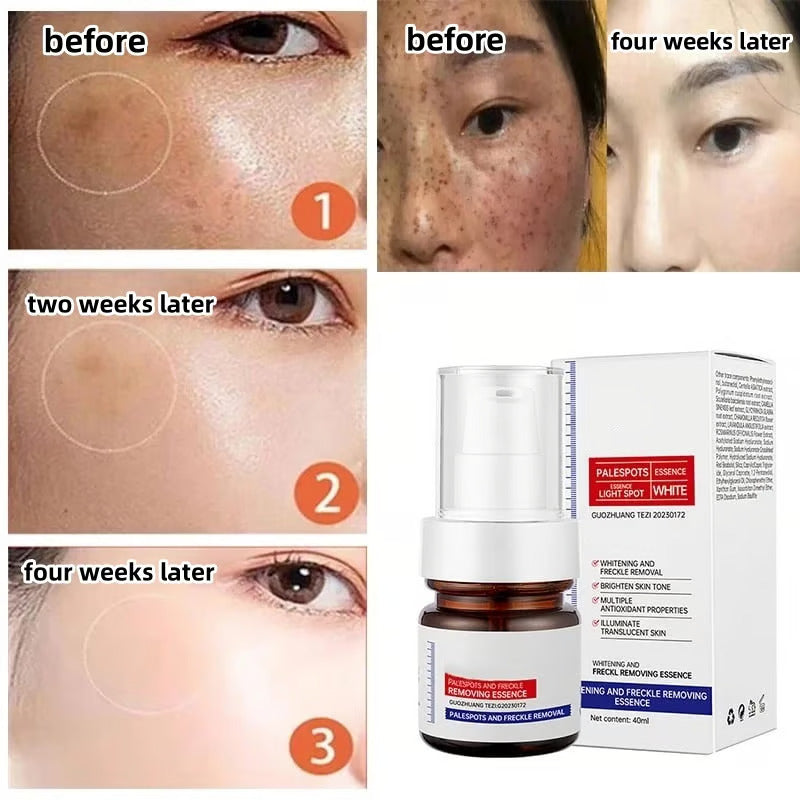 Whitening and Freckle Removing Essence